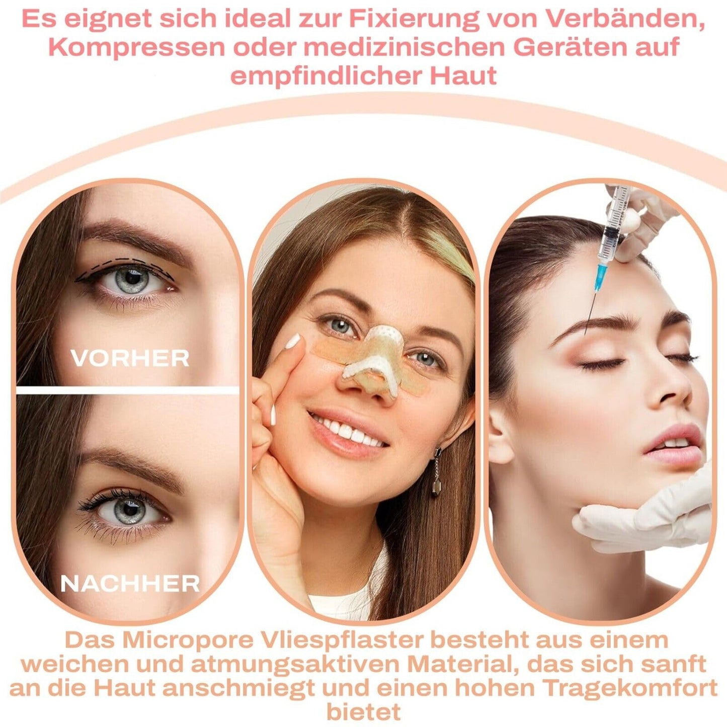 3M mikroporu lentes neausta plāksteris ādas krāsai ar uzklāšanas uzgaļiem no P-Beauty - medicīniskā līmlente skropstu pieaudzēšanai, ādas plāksteris hipoalerģisks, elpojošs, ūdensnecaurlaidīgs (1,25 cm x 9,14 m, 1 rullis)