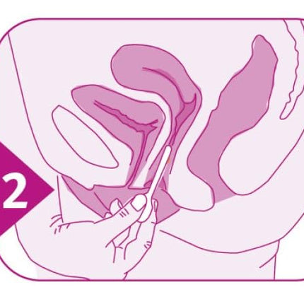 ELANEE maksts pH pašpārbaude bakteriālu infekciju agrīnai noteikšanai un grūtniecības aprūpei, plīsušas membrānas, bakteriālā vaginoze, bakteriālās vaginozes tests, 2 gab. (735-00)