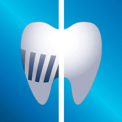 Philips Sonicare Original ProResults standarta Sonic zobu birstes uzgaļi — 8 gab. iepakojumā, baltā krāsā (modelis HX6018/07)