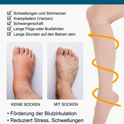 Medicīniskās kompresijas zeķes sievietēm un vīriešiem, 20-30 mmHg 2. klase, izmēri S-4XL, pakāpeniskas atbalsta kompresijas zeķes, atbalsta zeķes varikozām vēnām, tūskai un vēnu izspiešanai (bēša, XXL)