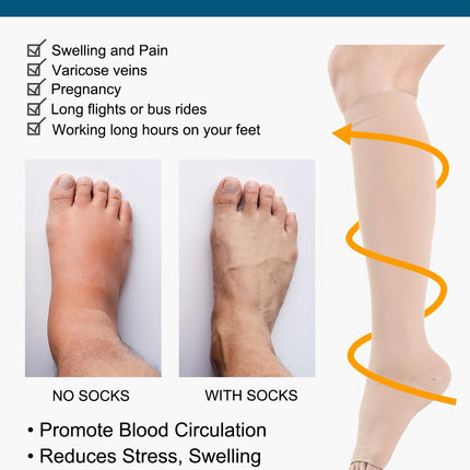 Medicīniskās kompresijas zeķes ar atvērtu purngalu sievietēm un vīriešiem 20-30 mmHg 2. klase, S-4XL izmērs, kompresijas zeķes, atbalsta zeķes varikozām vēnām, tūskai (bēša, M)