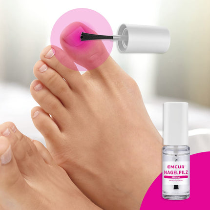 Emcur® serums | ar ārstēšanas plānu | ar 10 nagu vīlēm | Kāju nagi | Roku nagi kā pudele ar aplikatoru | 5 ml pietiek līdz 3 mēnešiem