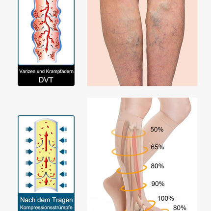 Medicīniskās kompresijas zeķes sievietēm un vīriešiem, 20-30 mmHg 2. klase, izmēri S-4XL, pakāpeniskas atbalsta kompresijas zeķes, atbalsta zeķes varikozām vēnām, tūskai un vēnu izspiešanai (bēša, XXL)
