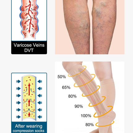 Medicīniskās kompresijas zeķes ar atvērtu purngalu sievietēm un vīriešiem 20-30 mmHg 2. klase, S-4XL izmērs, kompresijas zeķes, atbalsta zeķes varikozām vēnām, tūskai (bēša, M)