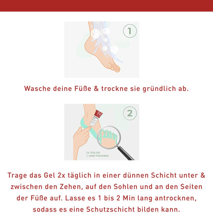 N1 gels pret sportista pēdu 30 ml - medicīniska ierīce - mazina niezi un aizsargā pret nepatīkamām smakām - krēms pret sportista pēdu ar aktīvo vielu Natilact - spēcīgs līdzeklis pret sportista pēdu