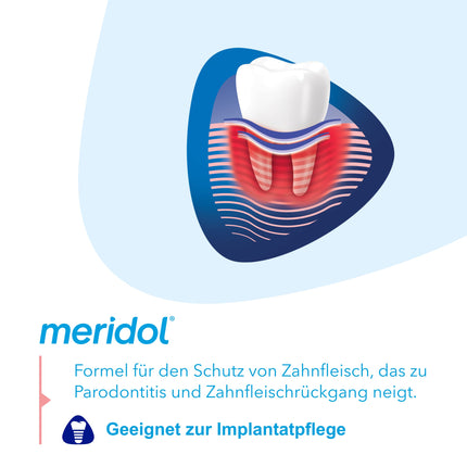 meridol mutes skalošanas līdzeklis Parodont Expert 400ml - antibakteriāla iedarbība, palīdz stiprināt smaganu izturību pret smaganu asiņošanas, periodontīta un smaganu recesijas cēloņiem