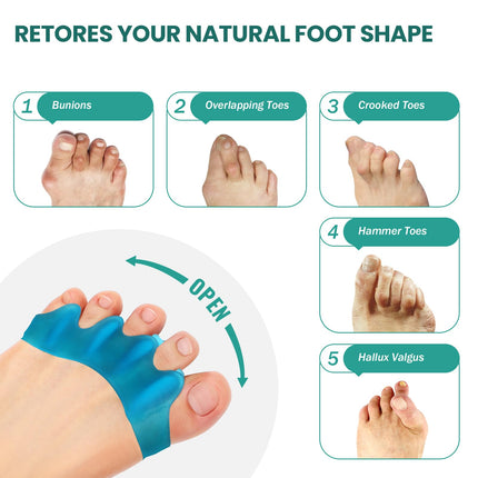 Welnove silikona pirkstu atdalītāji Hallux valgus korekcijai - 8 pirkstu sadalītāju iepakojums vīriešu pēdām - āmura pirkstu taisnotājs sievietēm, jogas vingrinājumi, pēdu izlīdzināšana - zils