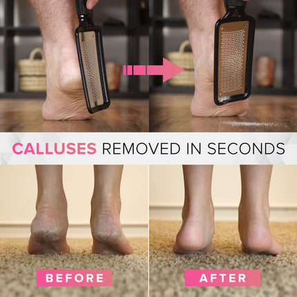 ULTIMATE Callus File Callus Remover pēdu kopšanai (liels) MEGAFILE Callus Planer Callus Removal Foot - Callus Rasp Callus Remover Spēcīgas tulznas Atmirušās ādas Pēdu skrāpis
