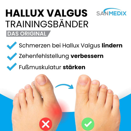Sanmedix Hallux valgus pirkstu izplešanas treniņu lente pirkstam - korekcijas komplekts sievietēm un vīriešiem bunionu sāpju mazināšanai