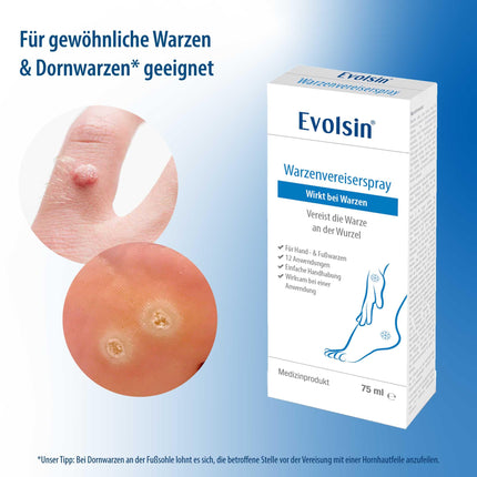 Evolsin® kārpu saldētava parastajām kārpām un vībotnēm | Kārpu sasaldēšana higiēniska un droša | Kārpu līdzeklis