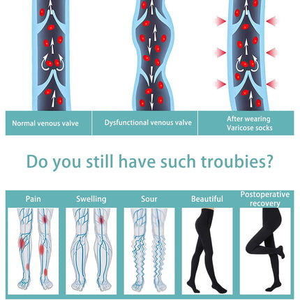 Evolyline 20-30mmHg medicīniskās kompresijas zeķubikses sievietēm un vīriešiem, garas, II klases ar slēgtu purngalu, pakāpeniskas kompresijas lipedema
