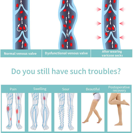 Evolyline medicīniskās kompresijas zeķes sievietēm un vīriešiem, zeķes ar augstu augšstilbu atbalstu un silikona joslu, 20–30 mmHg kompresijas zeķes gaisa ceļojumiem, sportam, pakāpenisks atbalsts varikozām vēnām