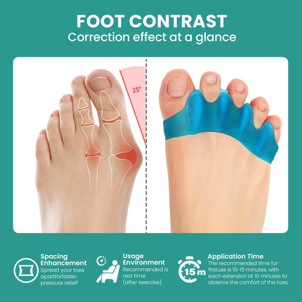 Welnove silikona pirkstu atdalītāji Hallux valgus korekcijai - 8 pirkstu sadalītāju iepakojums vīriešu pēdām - āmura pirkstu taisnotājs sievietēm, jogas vingrinājumi, pēdu izlīdzināšana - zils