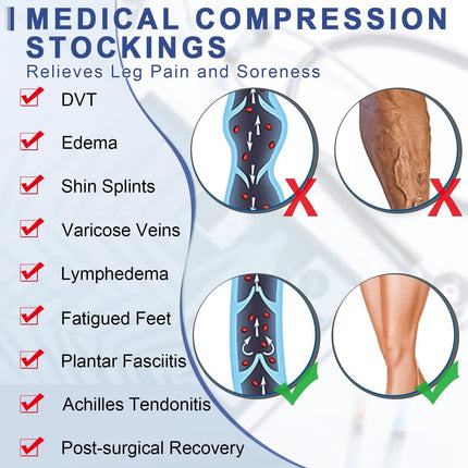 20-30 mmHg medicīniskās kompresijas zeķes sievietēm un vīriešiem, atbalsta zeķes ar slēgtiem purngaliem, pakāpenisks atbalsts varikozām vēnām, tūska