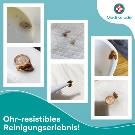 Vidējas klases ausu tīrīšanas līdzeklis - ausu sēra noņēmējs - drošs sūknis ausu sēra noņemšanai 300 ml - videi draudzīgs ausu tīrīšanas komplekts - uzlabo dzirdi