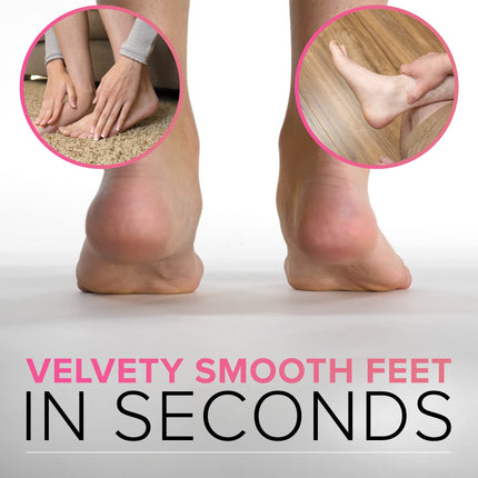 ULTIMATE Callus File Callus Remover pēdu kopšanai (liels) MEGAFILE Callus Planer Callus Removal Foot - Callus Rasp Callus Remover Spēcīgas tulznas Atmirušās ādas Pēdu skrāpis