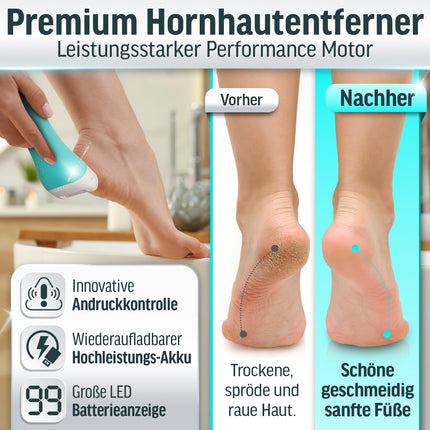 Grundig Electric Callus Remover Pro - ātri noņemiet ādas sacietējumus, neliecoties - Premium klases bezvadu ādas sacietējumu noņēmējs mitram + sausam darbam ar apgaismojumu, 3 pēdu rullīšiem, uzlādējams (ātrasepju noņēmējs)