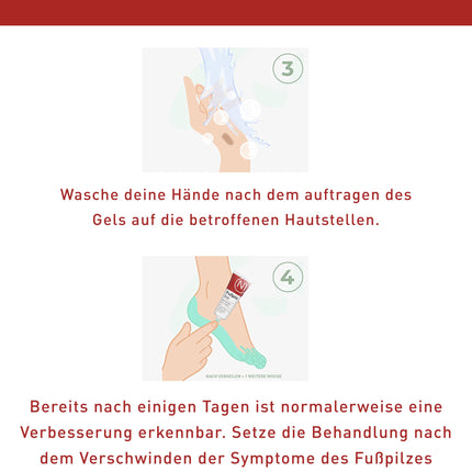 N1 gels pret sportista pēdu 30 ml - medicīniska ierīce - mazina niezi un aizsargā pret nepatīkamām smakām - krēms pret sportista pēdu ar aktīvo vielu Natilact - spēcīgs līdzeklis pret sportista pēdu