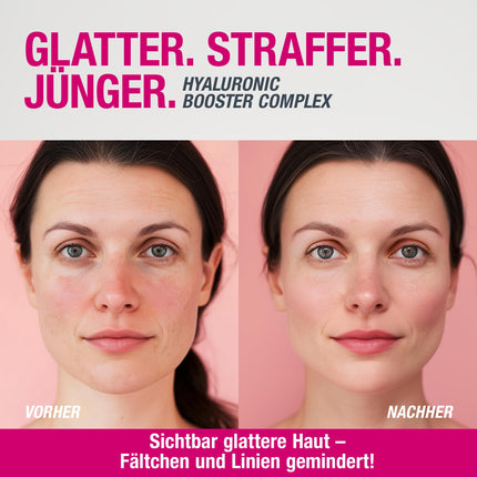 Augstas devas hialuronskābes serums PHYVE 200 ml, vegāns mitrinošs serums sejai, ražots Vācijā, ar 2% tīra, ļoti koncentrēta hialuronskābes pārdozēšanas pastiprinātāja no Svenjas Valbergas