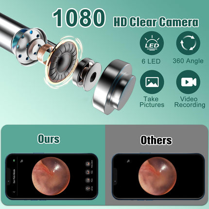 Ausu sēra noņēmēja otoskops, LMECHN 1080P HD otoskops, WiFi ausu tīrītājs ar kameru, otoskops ar 6 gaismas diodēm, IP67 ūdensizturīgs otoskopa auss, iPhone, Android, iPad, melns