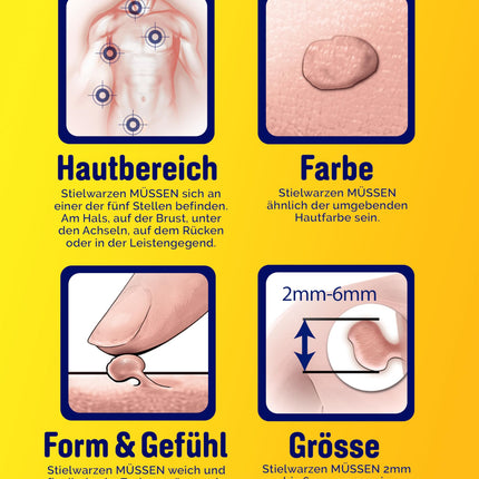 Scholl Freeze Away kārpu noņemšanas komplekts, noņem ādas izaugumus 1 procedūras laikā, klīniski pierādīts, ka noņem kārpas uz kakla, krūtīm, padusēm, muguras un cirkšņiem, 12 procedūras