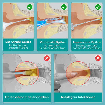 Vidējas klases ausu tīrīšanas līdzeklis - ausu sēra noņēmējs - drošs sūknis ausu sēra noņemšanai 300 ml - videi draudzīgs ausu tīrīšanas komplekts - uzlabo dzirdi