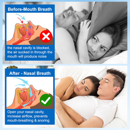 Krākšanas apturēšanas deguna strēmeles pret krākšanu - 120 deguna strēmeles Elpojiet labāk Deguna strēmeles, deguna strēmeles pret krākšanu miegam un sportam