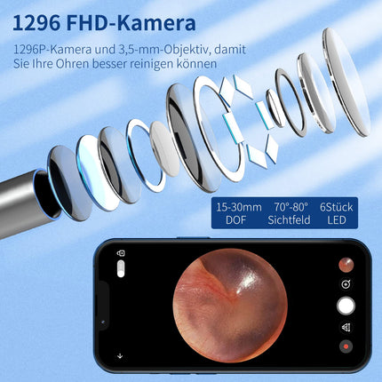 Ausu sēra noņemšanas otoskops, VITCOCO WiFi ausu tīrīšanas kamera 5MP HD ausu kamera IP67 ūdensnecaurlaidīgs otoskops 3,5 mm objektīva ausu endoskops ar 6 gaismas diodēm iPhone, iPad un Android viedtālruņiem (melns)